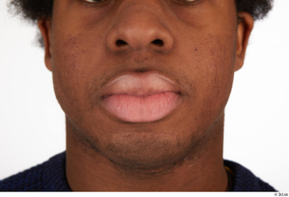 Photos of Allvince Epps mouth 0001.jpg